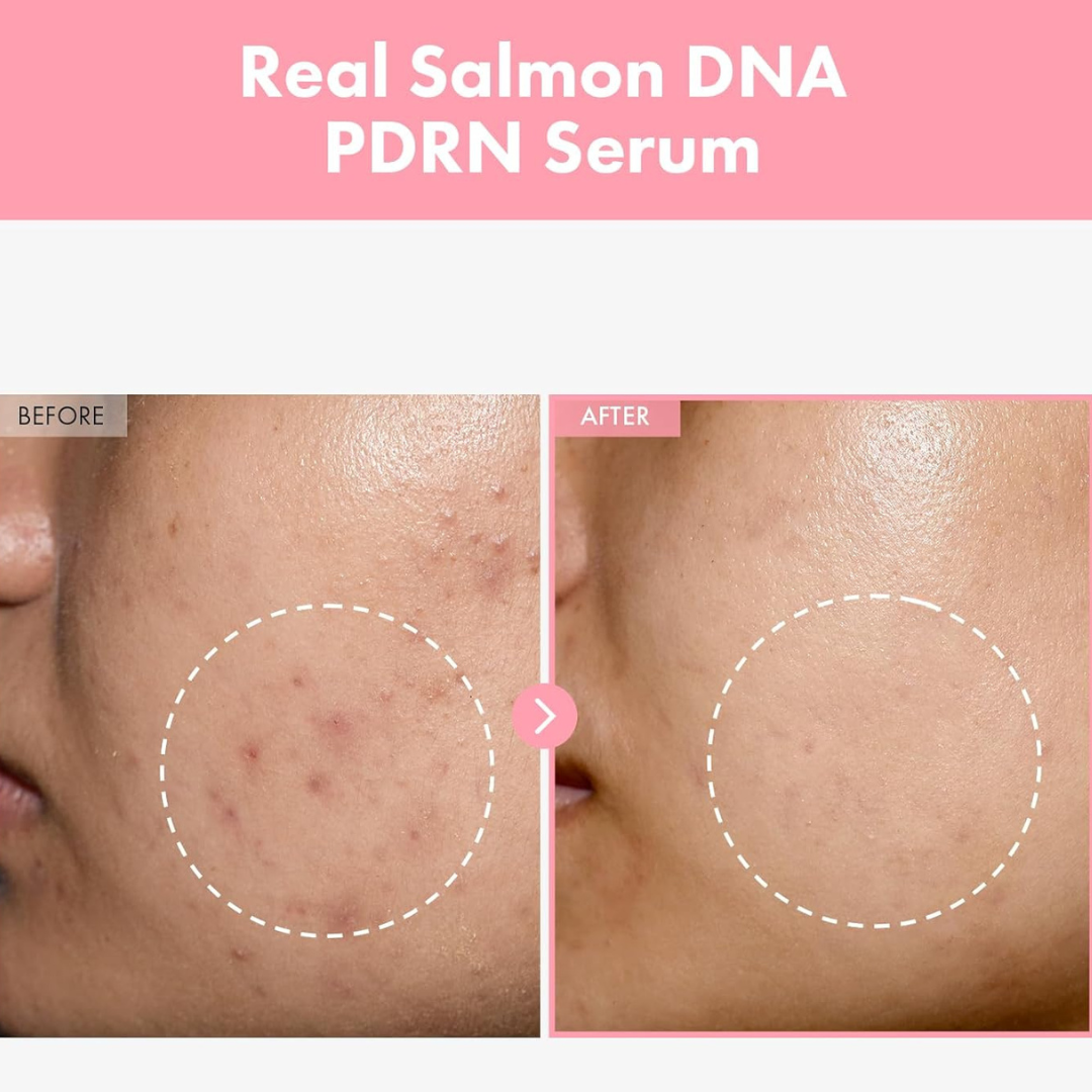 Glow Grace™ Salmon PDRN Collagen Mask